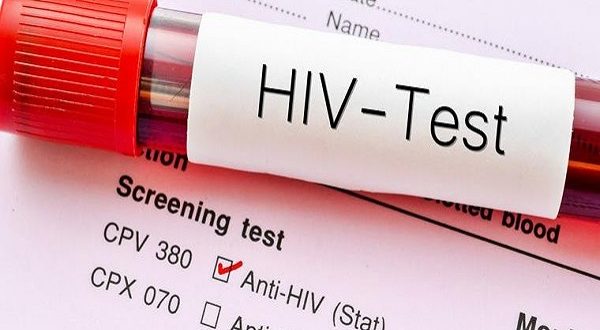 Over 2,720 People In Birim Central Municipality Are Living With HIV.